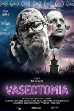 Vasectomia